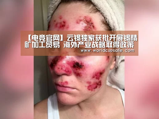 LOL直播